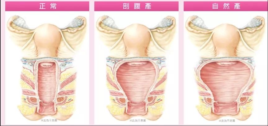 全球仅有10几例，宝宝带“玉”出生！原来是因为……