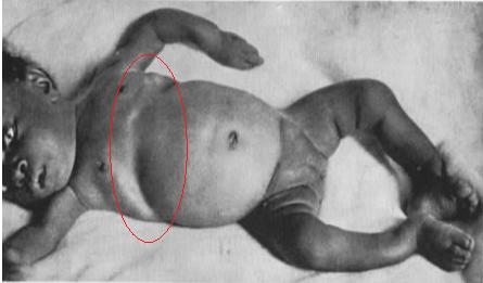 怎么查小月龄宝宝缺不缺维生素d,宝宝冬季怎么补充维生素