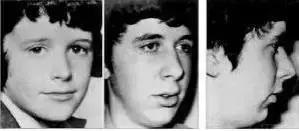 纠正张嘴呼吸会变丑的方法,张嘴睡觉鼻子呼吸会变丑吗