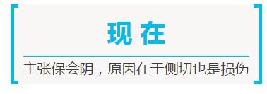 生孩子，你需要做会阴侧切么？