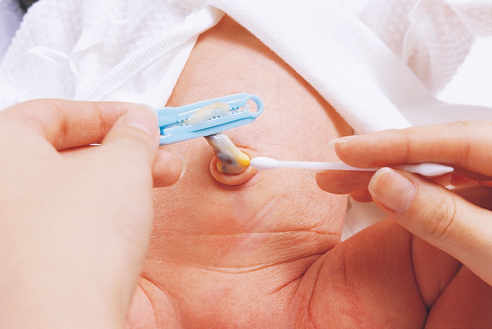 新生儿要保护哪些地方,新生儿宝宝重点保护部位