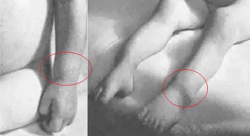 怎么查小月龄宝宝缺不缺维生素d,宝宝冬季怎么补充维生素