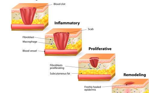 剖宫产孕妇伤口怎么处理,产妇剖宫产后刀口疼怎么缓解