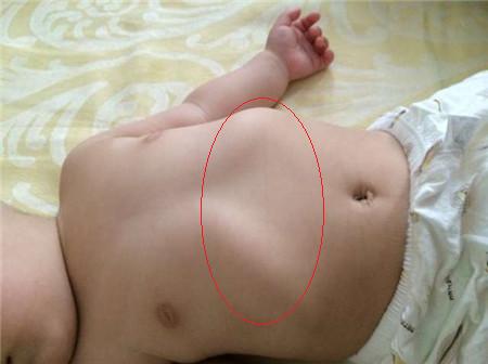 怎么查小月龄宝宝缺不缺维生素d,宝宝冬季怎么补充维生素