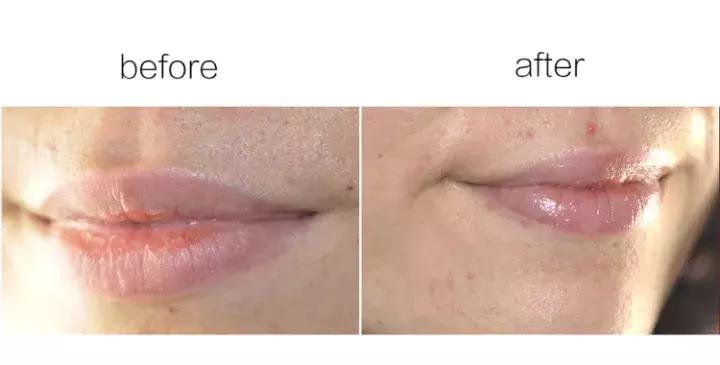 冬季嘴唇干燥起皮用什么唇膏好,十大好用冬季润唇膏排行榜