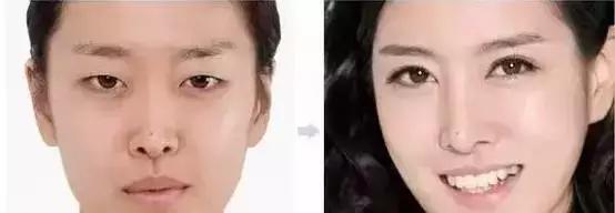 纹眉后有啥关注事项,纹眉后关注事项要用修复精华吗