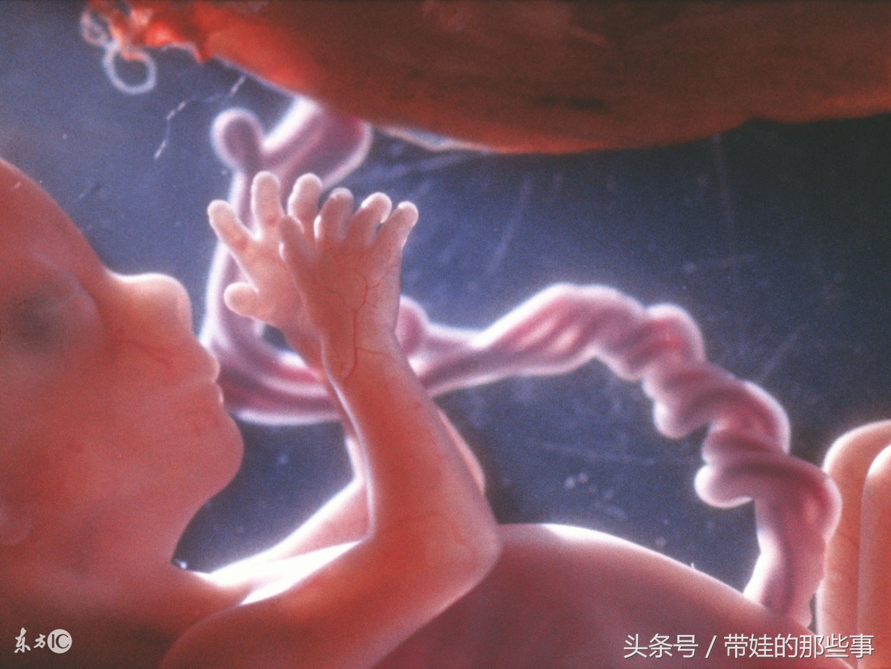 脐带绕颈一周怎么办孕30周,宝宝脐带绕颈两周该怎么和宝宝说