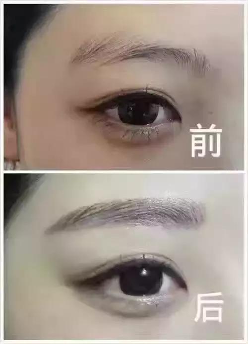 纹眉后有啥关注事项,纹眉后关注事项要用修复精华吗