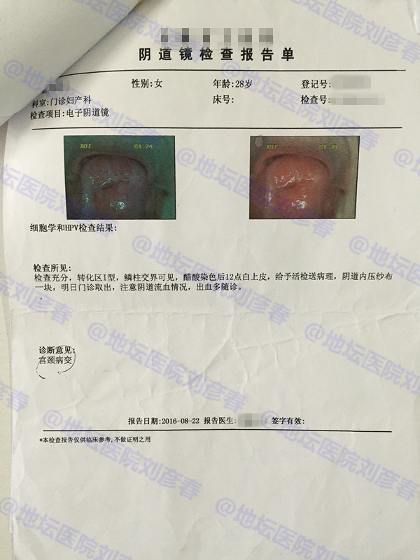 hpv18是尖锐性湿疣吗,hpv感染病例分享