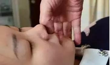 肝跟心脏不好拍打一个地方,肝脏不好拍打什么地方