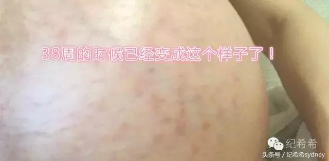 孕期产后修复动作,孕期产后恢复身材最全攻略