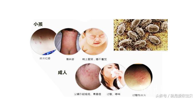 育儿锦囊新生儿,婴儿枕头知识大全