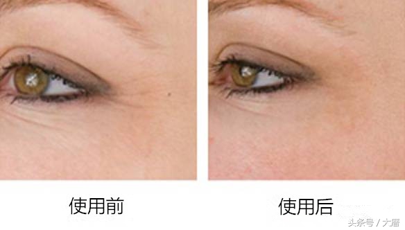 七种网红美容仪,深扒抖音网红美肤