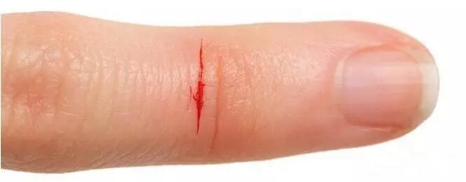 平安好医生解决难题,平安好医生医疗问诊