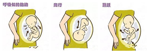 孕期胎动怎么感觉有点疼,有关孕期胎动问题咨询