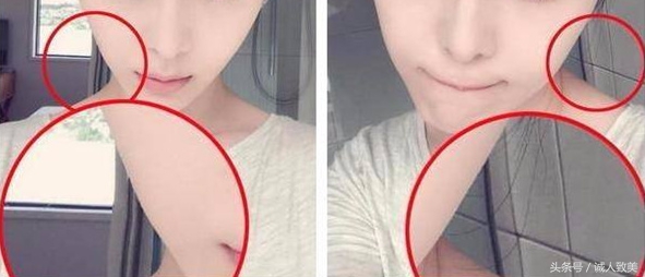 在家如何矫正歪鼻梁,歪鼻梁怎么修容