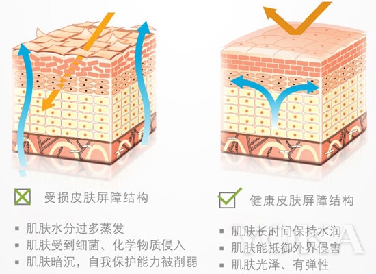 皮肤过敏脱皮发痒怎么办,皮肤过敏瘙痒脱皮怎么办