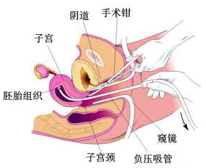 想要好孕怎么办,想要好孕都有什么技巧