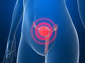 子宫癌原来这样治疗，一半以上的病人可以治愈！