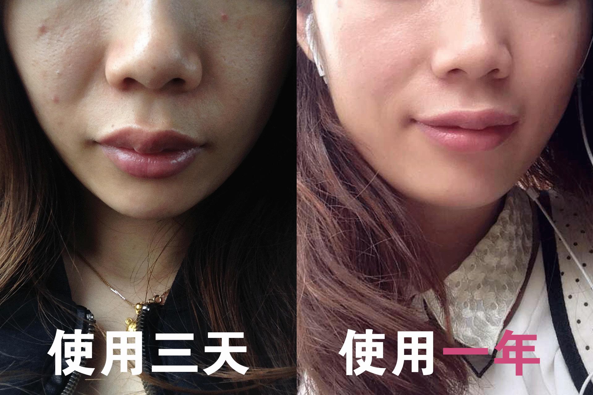 分享十几年的护肤经验全部自用,皮肤科博士护肤保养经验心得