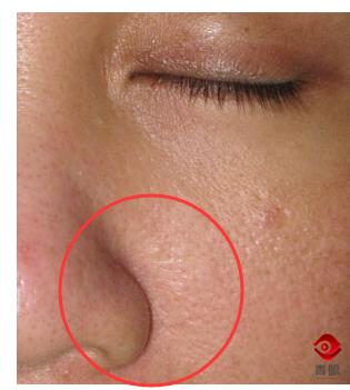 鼻翼两侧脏脏的,为什么鼻翼总是卡粉