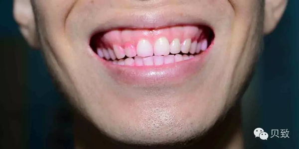 牙博士几款牙膏真实测评,贝医生原力唤醒美白牙膏测评