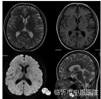 「高精设备」顶级MR7503.0T磁共振，疯狂打Call~