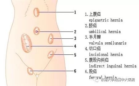 「聚焦」第二届中大论坛收官之作，中外微创外科名家金陵“论剑”