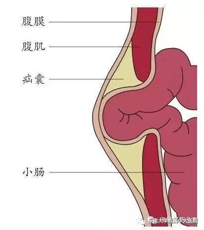 「聚焦」第二届中大论坛收官之作，中外微创外科名家金陵“论剑”