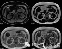 「高精设备」顶级MR7503.0T磁共振，疯狂打Call~