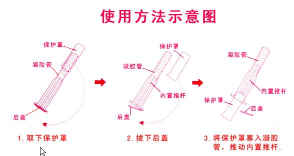 私护凝胶能治妇科病吗,女性私护凝胶效果可靠吗