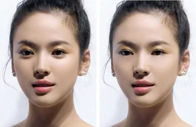 眼袋显老还是泪沟显老,40岁眼袋有泪沟怎么办