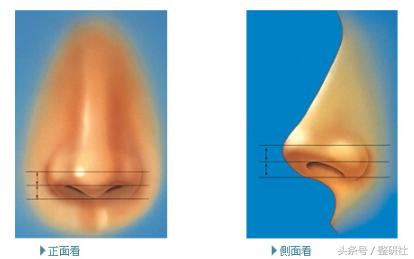女生怎么逆袭蒜头鼻,女生通天鼻怎么修