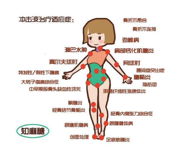 康复科治疗落枕得去几次,骨科医生怎么治疗落枕