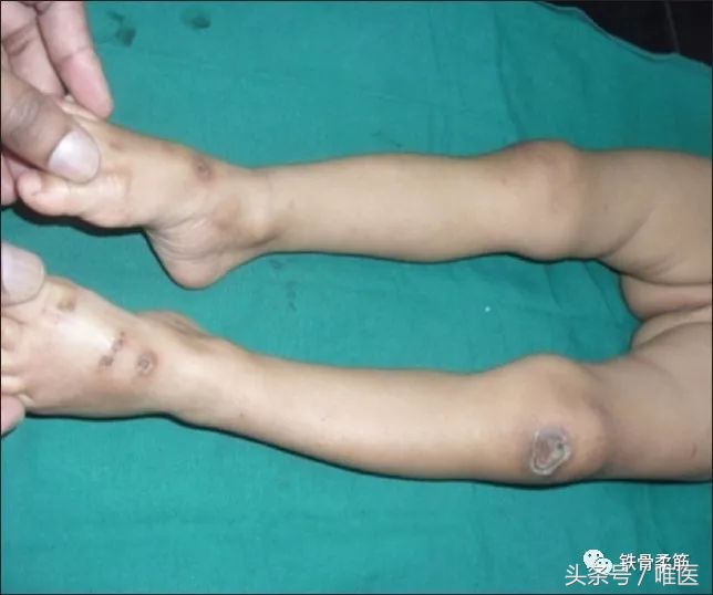 做手术病人感觉不疼,做手术时真的不疼吗