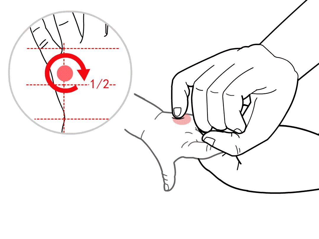 小儿湿热泄泻小儿推拿案例分析,肝胆湿热小儿推拿都用什么手法