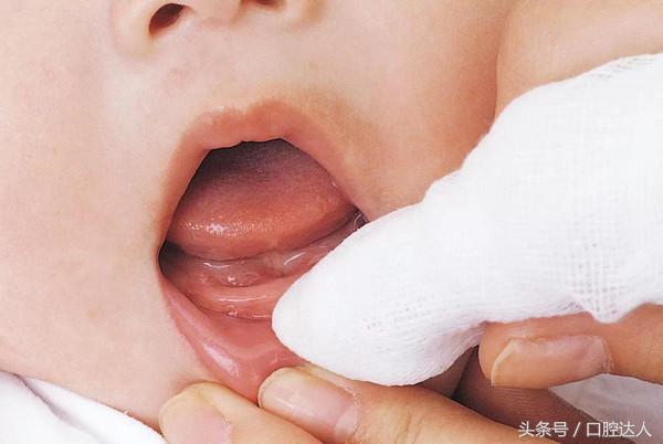 婴儿开始长乳牙该如何护理口腔,宝宝长恒牙怎么护理