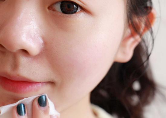 冬季脸蛋容易发红发烫，你可以这样护理皮肤