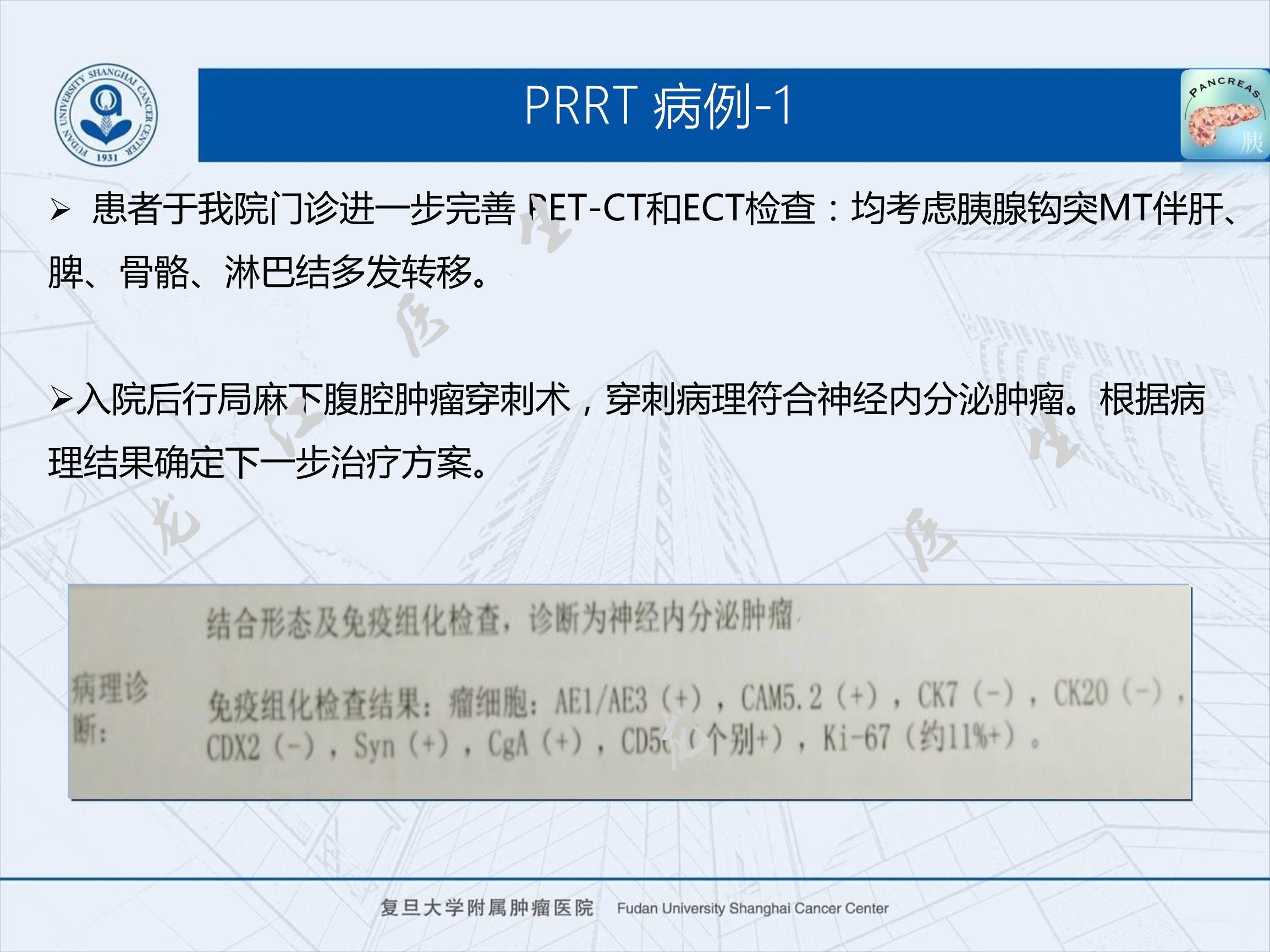 prrt治疗神经内分泌副作用,神经内分泌瘤ssrt