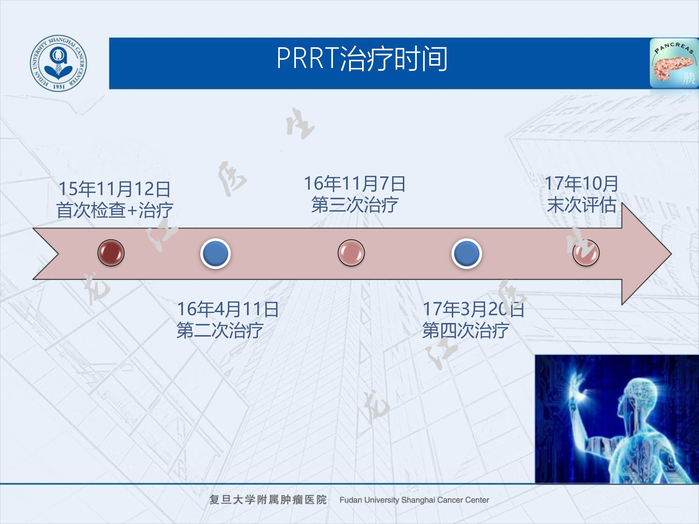prrt治疗神经内分泌副作用,神经内分泌瘤ssrt