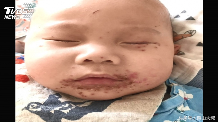 不要亲宝宝脸和嘴,不要亲婴儿