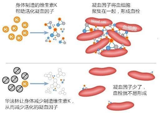 冠心病合并房颤抗血栓用药,心脏房颤如何防心衰
