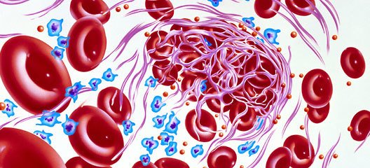 冠心病合并房颤抗血栓用药,心脏房颤如何防心衰