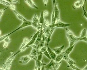 科普：皱纹成因，以及对抗方法