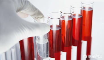 肾盂肿瘤发现血尿严重吗,发现血尿后做什么检查