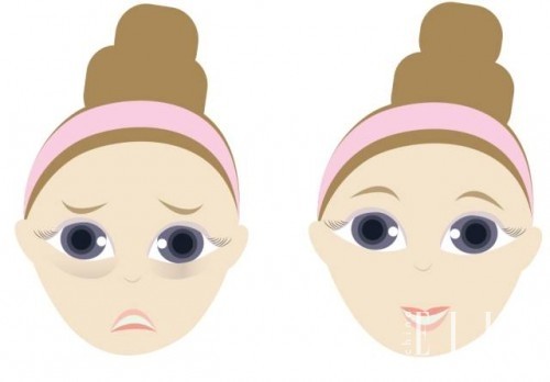 男士消除眼袋最好的眼霜是什么,男士眼霜去黑眼圈眼袋哪个牌子好