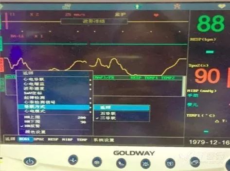 心电监护仪常见问题及其解决方法,心电监护仪有什么用