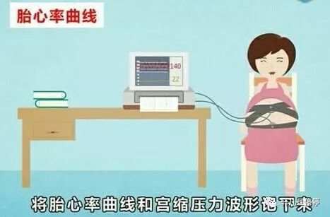 胎心监护不合格要一直做到合格吗,胎心监护不过关有必要重做嘛