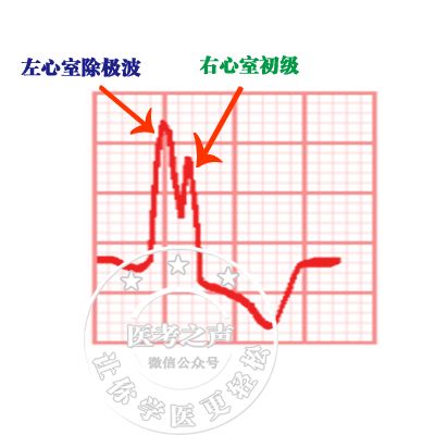 心电图秒懂,心电图零基础都秒懂