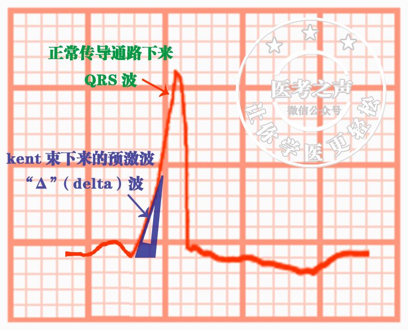 心电图秒懂,心电图零基础都秒懂